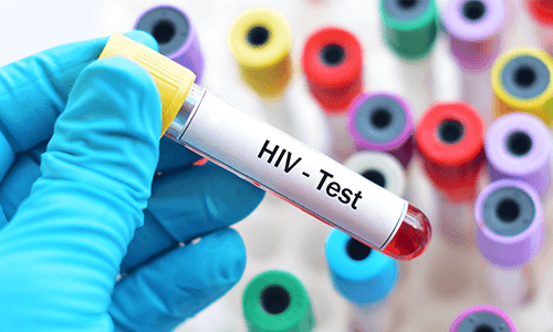 Bundesrat: HIV-Selbsttest frei verkäuflich