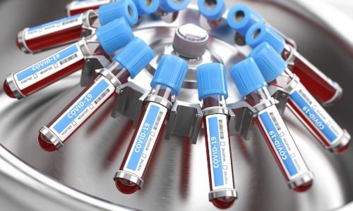 Ein Test auf Corona Antikörper schafft Klarheit